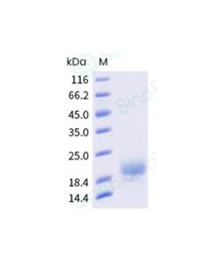 Recombinant Human CTLA-4 Protein, HPLC-verified sinobiological 11159-HNAH