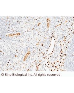 Anti-IL-33 Antibody, Mouse Monoclonal sinobiological 10368-MM13