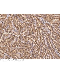 Anti-GM130/GOLGA2 Antibody, Rabbit Polyclonal sinobiological 102306-T08