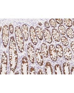 Anti-GPA33/A33 Antibody, Rabbit Polyclonal sinobiological 206521-T08