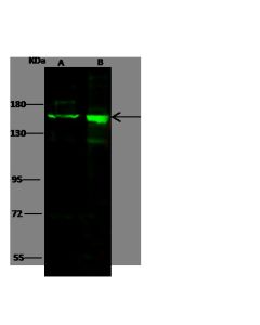 Anti-DROSHA Antibody, Rabbit Polyclonal sinobiological 102288-T32