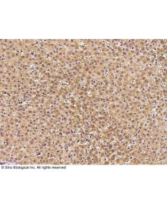 Anti-ALR Antibody, Rabbit Polyclonal sinobiological 15278-T24