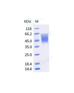 Recombinant Human B7-2/CD86 Protein (His Tag) sinobiological 10699-H08H