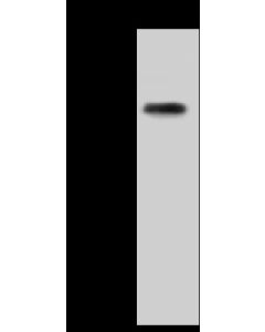 Anti-GFR Alpha-3/GFRA3 Antibody, Rabbit Polyclonal sinobiological 50901-T48