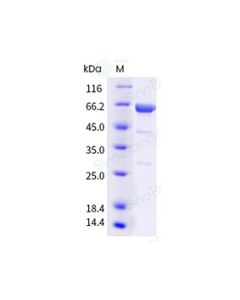 Influenza A H5N1 (A/Cambodia/NPH230032/2023) Hemagglutinin / HA Protein (ECD, His Tag) sinobiological 40945-V08B