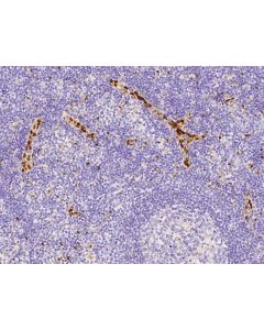Anti-IL-33 Antibody, Rabbit Polyclonal sinobiological 10368-T24