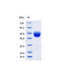Recombinant Human CD38 Protein (ECD, His Tag), HPLC-verified sinobiological 10818-H08H