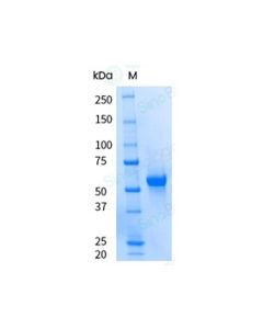 Recombinant Human LAG-3 Protein (ECD, His Tag), HPLC-verified, Endotoxin-Free sinobiological 16498-H08H-UE