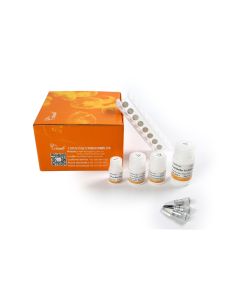 MagicPure® Viral DNA/RNA Kit（with Magnetic Stand） transgen EC301-01