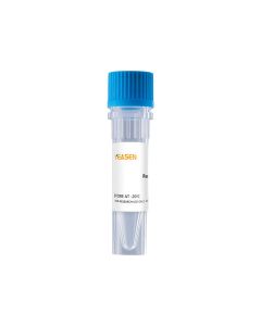 Recombinant Human Melanoma Inhibitory Activity Protein (Human MIA) _ 92576ES yeasen