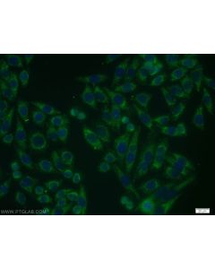 VEGFR-1/FLT-1 Polyclonal antibody 13687-1-AP proteintech