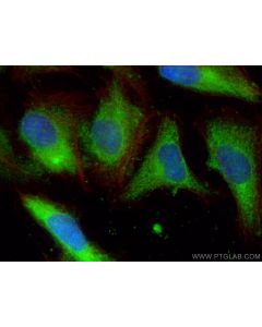 Galectin-1 Monoclonal antibody 60223-1-Ig proteintech