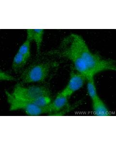 Angiopoietin 1 Monoclonal antibody 68618-1-Ig proteintech