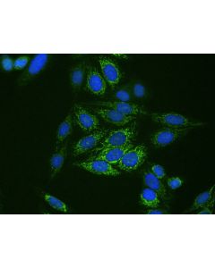 CPS1 Recombinant monoclonal antibody 84277-1-RR proteintech