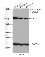 p115, USO1 Polyclonal antibody proteintech 13509-1-AP