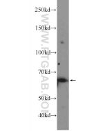 RNF8 Polyclonal antibody proteintech 14112-1-AP