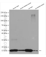 FABP3 Polyclonal antibody proteintech 10676-1-AP