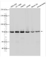 METTL3 Polyclonal antibody proteintech 15073-1-AP