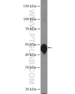 Cytokeratin 13 Polyclonal antibody proteintech 10164-2-AP