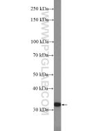 CHMP2A Polyclonal antibody proteintech 10477-1-AP