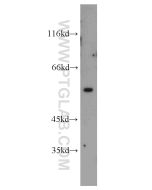 Vimentin Polyclonal antibody proteintech 22031-1-AP