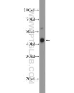 TCF1/TCF7 Polyclonal antibody proteintech 14464-1-AP