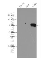 KLK3/PSA Polyclonal antibody proteintech 10679-1-AP