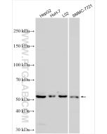 CYP7A1 Polyclonal antibody proteintech 18054-1-AP