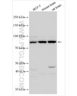Cullin 5 Polyclonal antibody proteintech 31183-1-AP