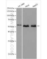SMAD1 Polyclonal antibody proteintech 10429-1-AP