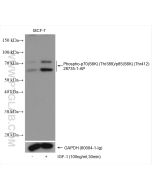 Phospho-p70(S6K) (Thr389)/p85(S6K) (Thr412) Polyclonal antibody proteintech 28735-1-AP