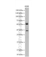 MMP14 / MT1-MMP Polyclonal antibody proteintech 14552-1-AP