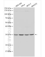 RPS3 Polyclonal antibody proteintech 11990-1-AP