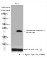 Phospho-EIF2S1 (Ser51) Polyclonal antibody proteintech 28740-1-AP