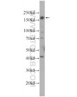 CEP164 Polyclonal antibody proteintech 22227-1-AP