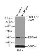 EEF1A1 Polyclonal antibody proteintech 11402-1-AP