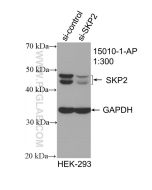 SKP2 Polyclonal antibody proteintech 15010-1-AP