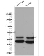 CaMKII alpha Polyclonal antibody proteintech 13730-1-AP