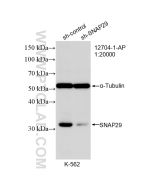 SNAP29 Polyclonal antibody proteintech 12704-1-AP