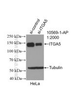 Integrin alpha-5/CD49e Polyclonal antibody proteintech 10569-1-AP