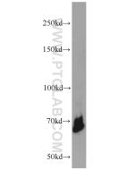 YY1 Polyclonal antibody proteintech 22156-1-AP