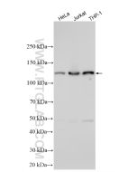 HDAC4 Polyclonal antibody proteintech 17449-1-AP