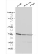 ADAM10 Polyclonal antibody proteintech 25900-1-AP