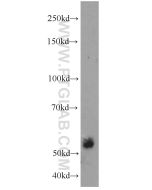 ECM1 Polyclonal antibody proteintech 11521-1-AP