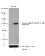 Phospho-p38 MAPK (Thr180/Tyr182) Polyclonal antibody proteintech 28796-1-AP
