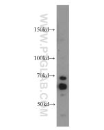 CDC25A Polyclonal antibody proteintech 55031-1-AP