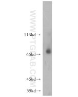 MMP8 Polyclonal antibody proteintech 17874-1-AP