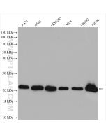 BID Polyclonal antibody proteintech 10988-1-AP