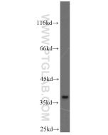 MAT2B Polyclonal antibody proteintech 15952-1-AP