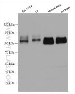 APP/Beta Amyloid Polyclonal antibody proteintech 25524-1-AP